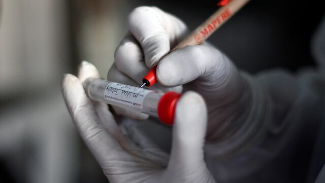 Prueba de laboratorio