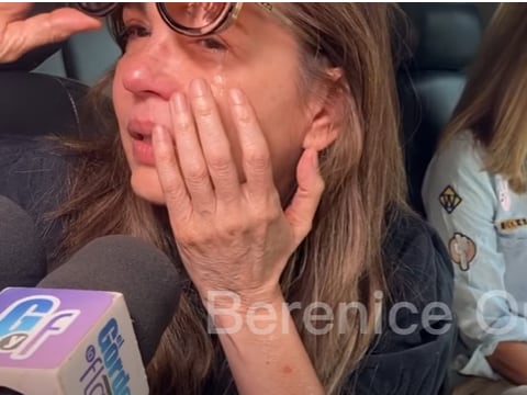 Yolanda Andrade muestra el ojo afectado por el aneurisma cerebral.