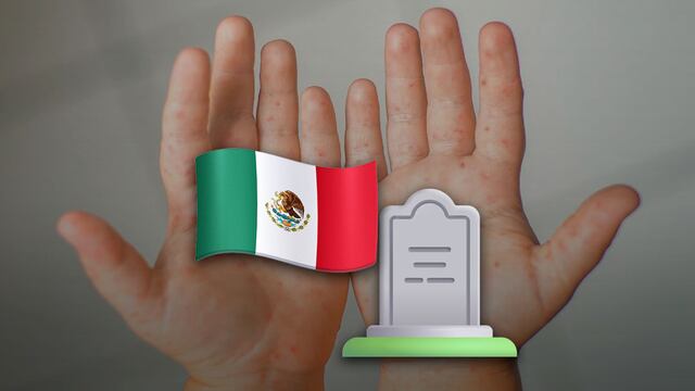 Casos de sarampión en México