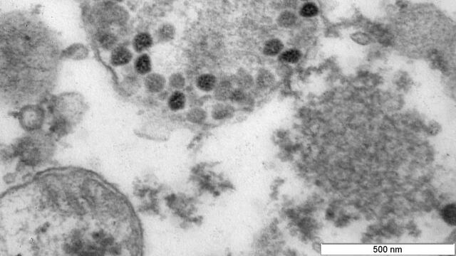 Foto de alta calidad de variante Ómicron