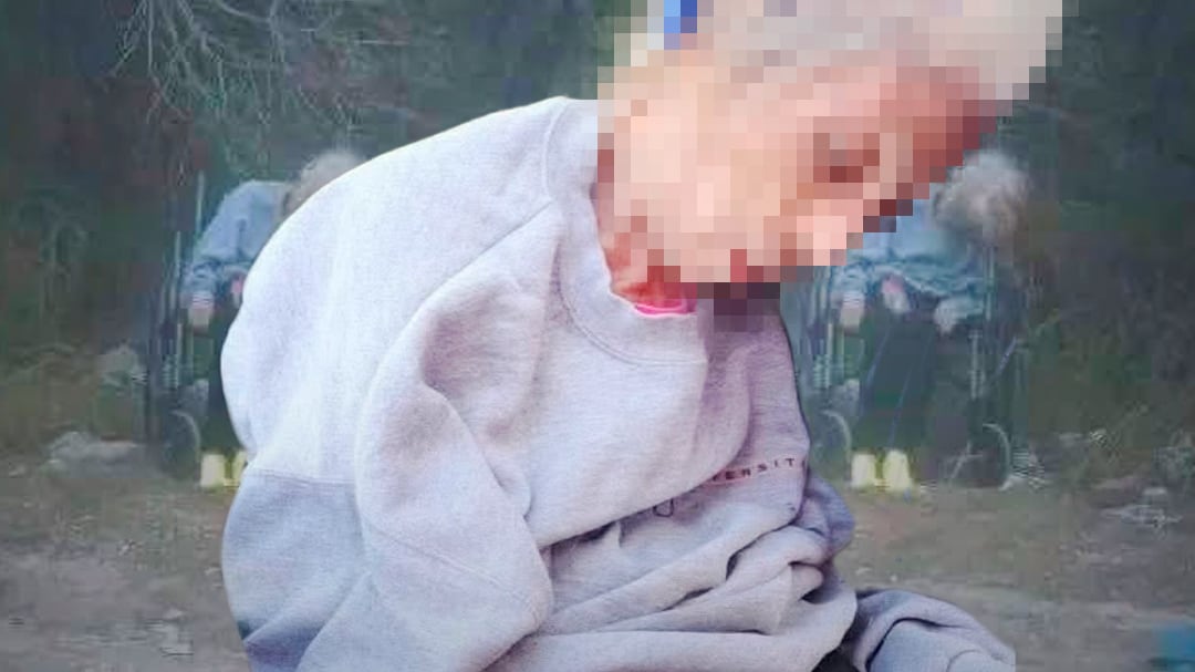 Identifican a adulta mayor abandonada en Playa Bagdad; habría sido sedada