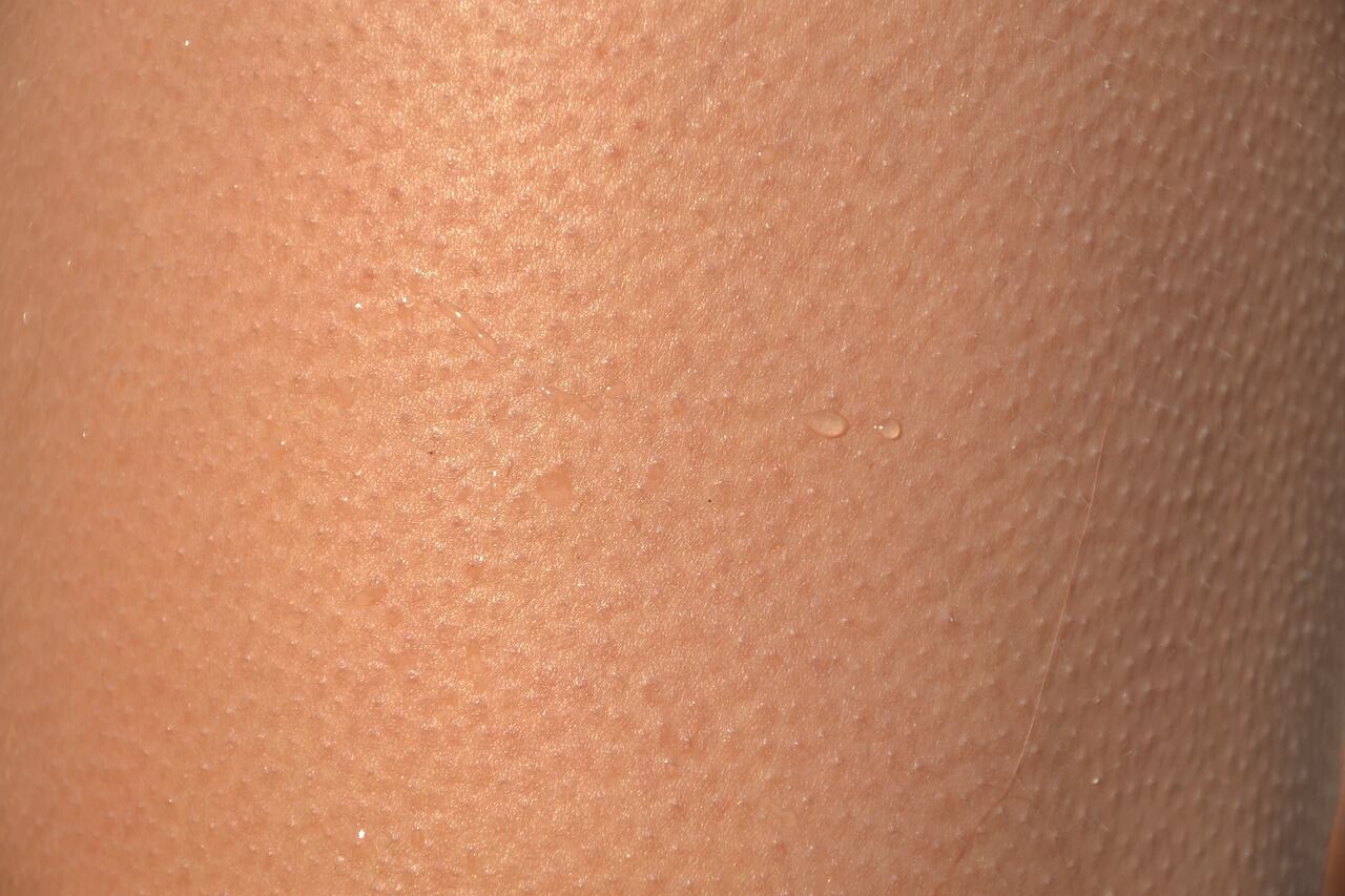 "Piel chinita"