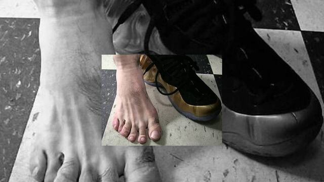 VIDEO: Increíble, campeón de box tiene seis dedos en el pie