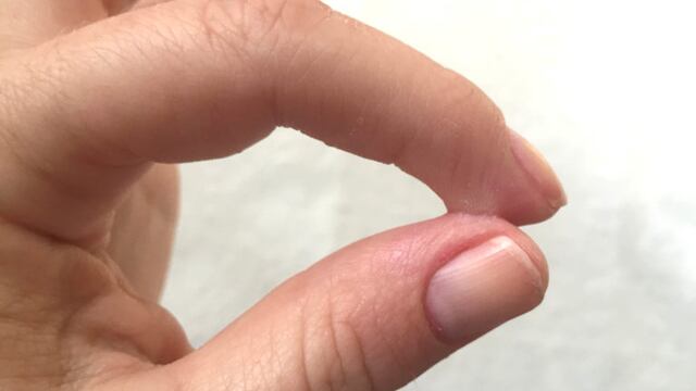 Dedos pegados con Kola Loka