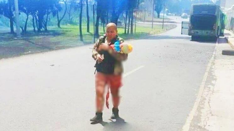Niña Jazlyn recibe su primera operación en Texas tras explosión en Iztapalapa