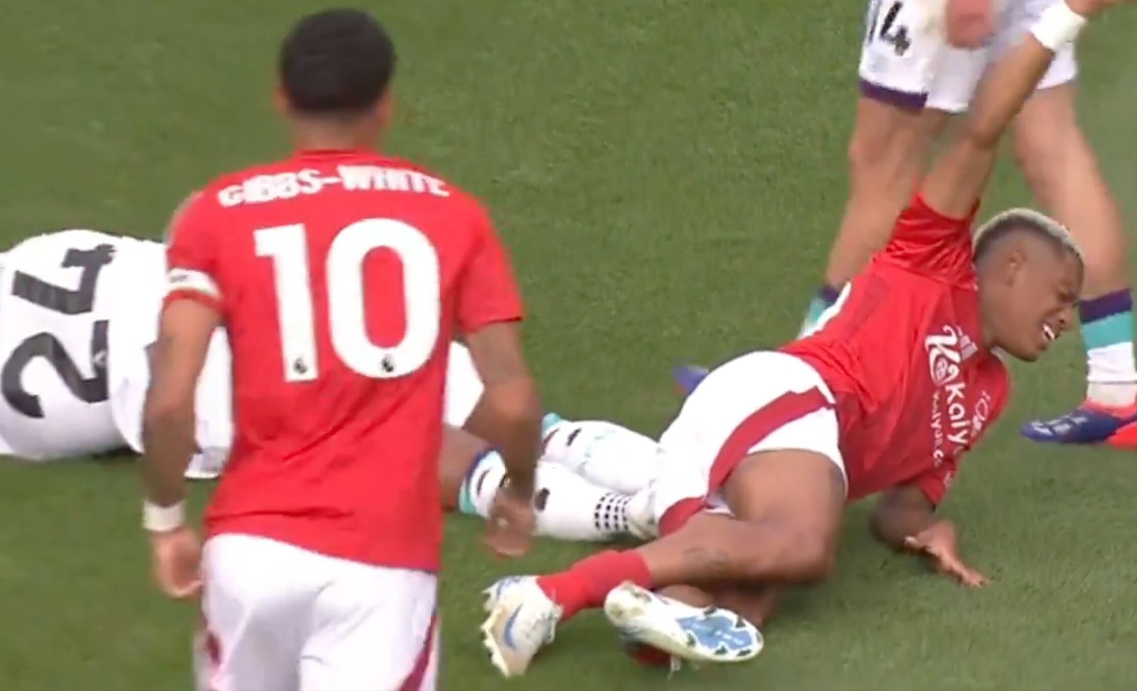 Jugador de la Premier League sufre una terrible fractura