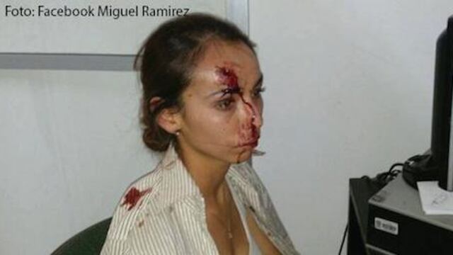 Karla Silva fue agredida el 4 de septiembre. Foto/Especial