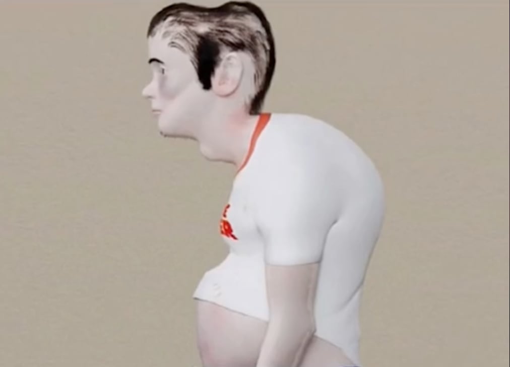 Este sería el aspecto físico que los gamers tendrían además de la abolladura en la cabeza