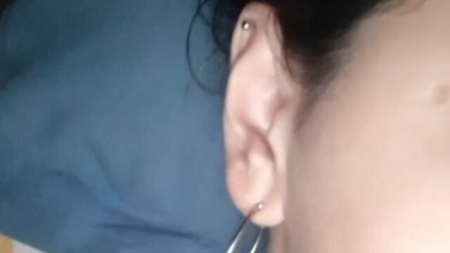 La usuaria mostró las consecuencias de no asistir con un profesional