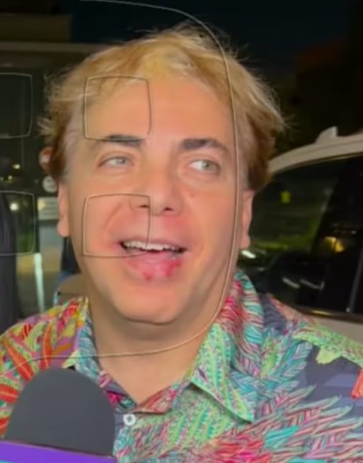 Cristian Castro preocupa por el aspecto de sus labios