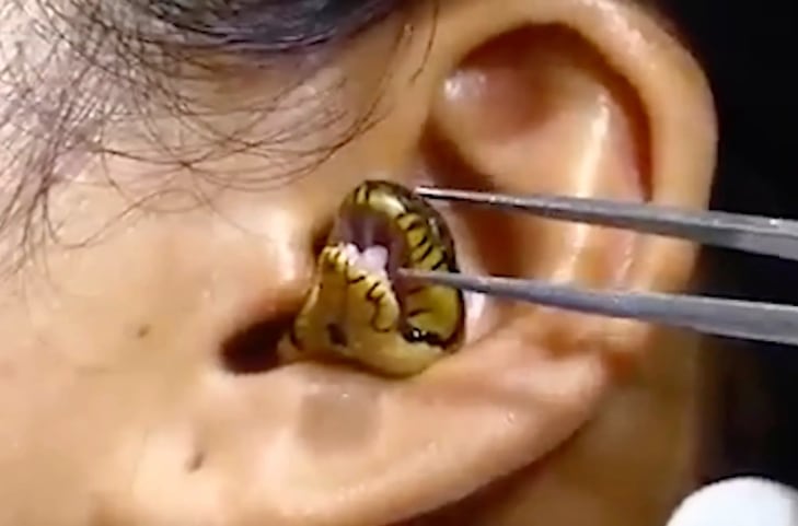 Serpiente viva en oreja de mujer