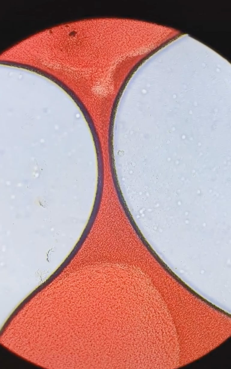 Coágulo de sangre menstrual bajo el microscopio
