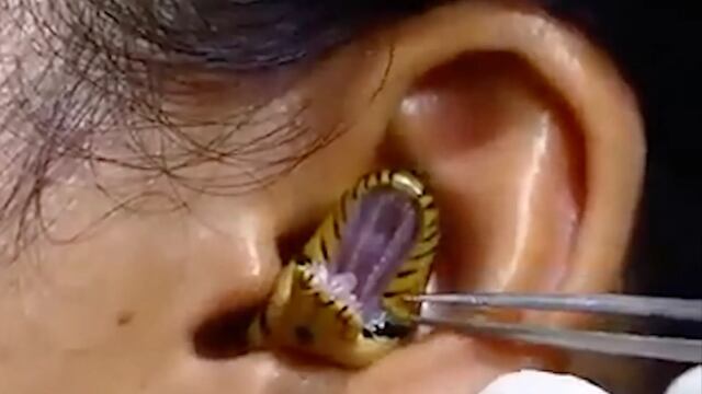 Serpiente viva en oreja de mujer