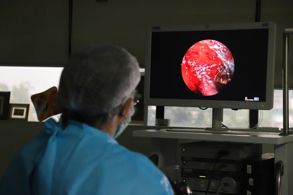Un hombre de 34 años contrajo mucormicosis mientras se recuperaba de Covid-19