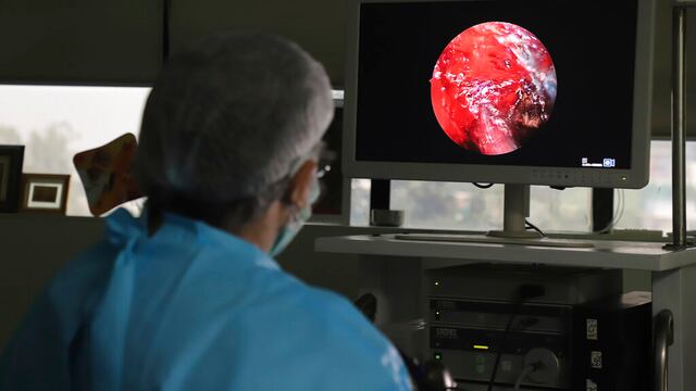 Un hombre de 34 años contrajo mucormicosis mientras se recuperaba de Covid-19