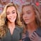 Denise Richards sorprende por su cambio de imagen después de una cirugía facial
