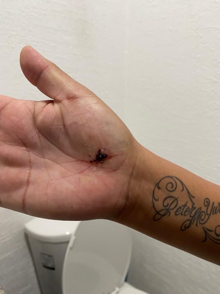 moretones y golpes a la víctima agredida en Querétaro por sus vecino/ @NiUnaMasQroFemi