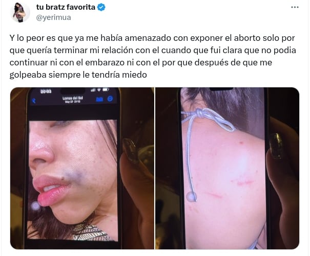 Yeri Mua comparte fotografías del golpe que le dio Naim Darrechi