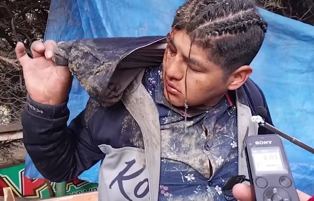 Víctor Hugo, quien despertó en el ataúd