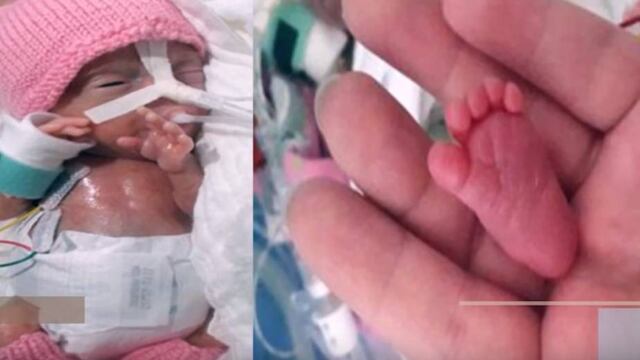 La bebé más pequeña del mundo.