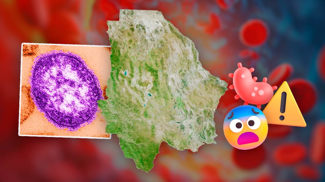 Sarampión en México 2025: Este estado concentra el mayor número de casos de contagio