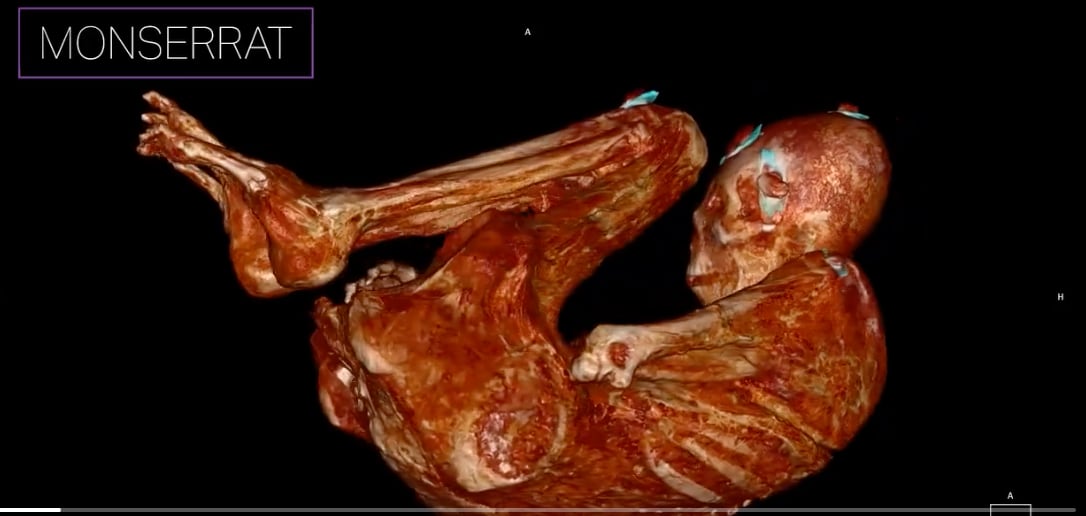 ¿Es extraterrestre? Jaime Maussan muestra tomografía a otro ser no humano embarazado