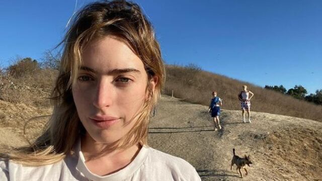 Clara McGregor asiste a una alfombra roja tras ser mordida por un perro