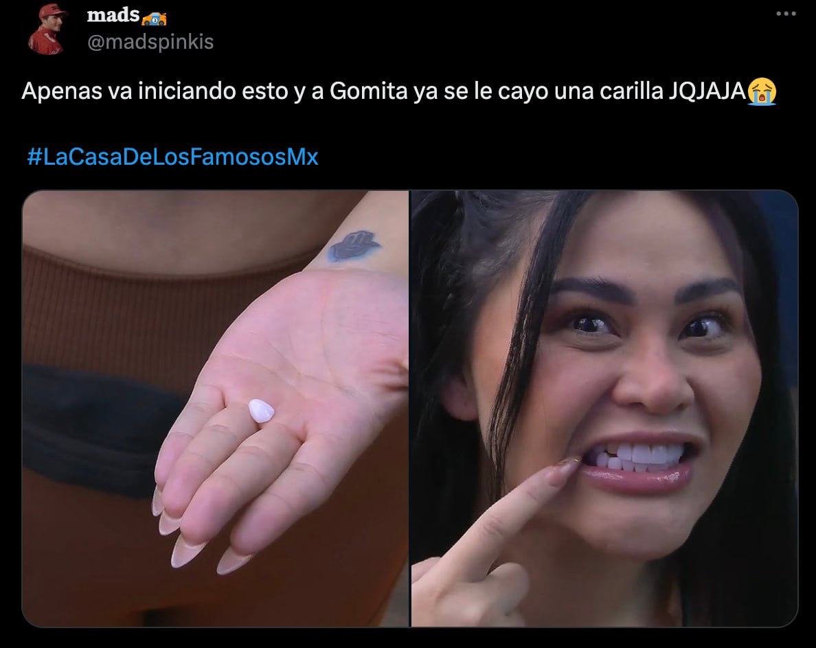 Gomita se queda sin un diente en su segundo día en La Casa de los Famosos México 2024