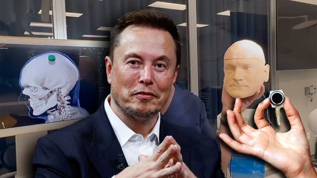 Así funciona Telepathy, la novedad de Neuralink, empresa de Elon Musk