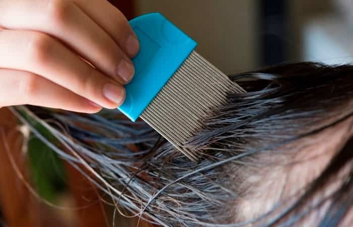 cepillo especial para quitar los piojos/internet