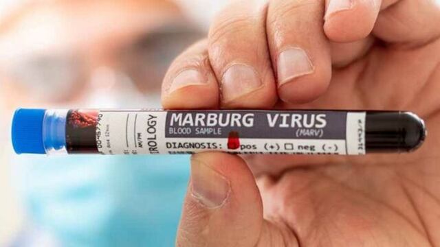 ¿Qué es el virus de Marburgo?