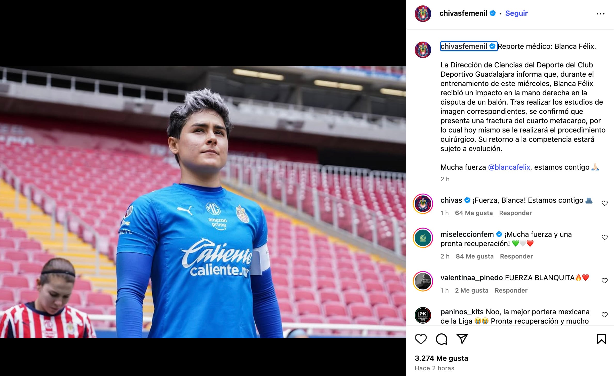Blanca Félix sufre lesión con Chivas Femenil
