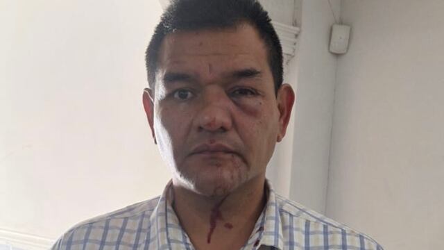 Abogado que lleva litigio contra Grupo Orlegi sufrió un atentado