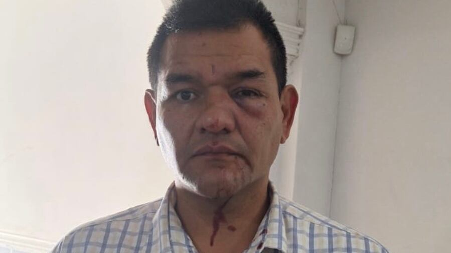 Abogado que le ganó demanda millonaria a Grupo Orlegi denuncia atentado en su contra; hace responsable a Alejandro Irarragorri