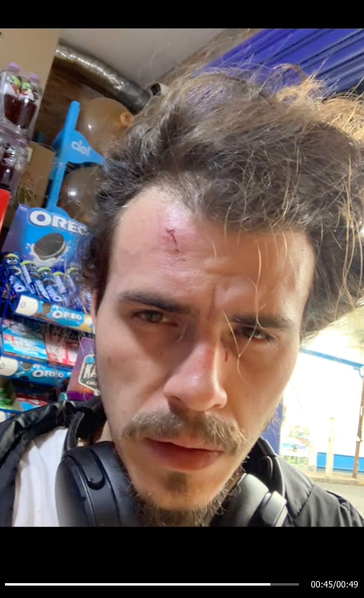 VIDEO: Le cae una maceta en la cabeza y casi no la cuenta; ahora TikTok quiere saber si ya fue al doctor