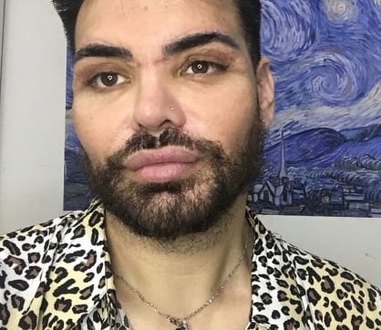 Se operó para parecerse a Ricky Martin