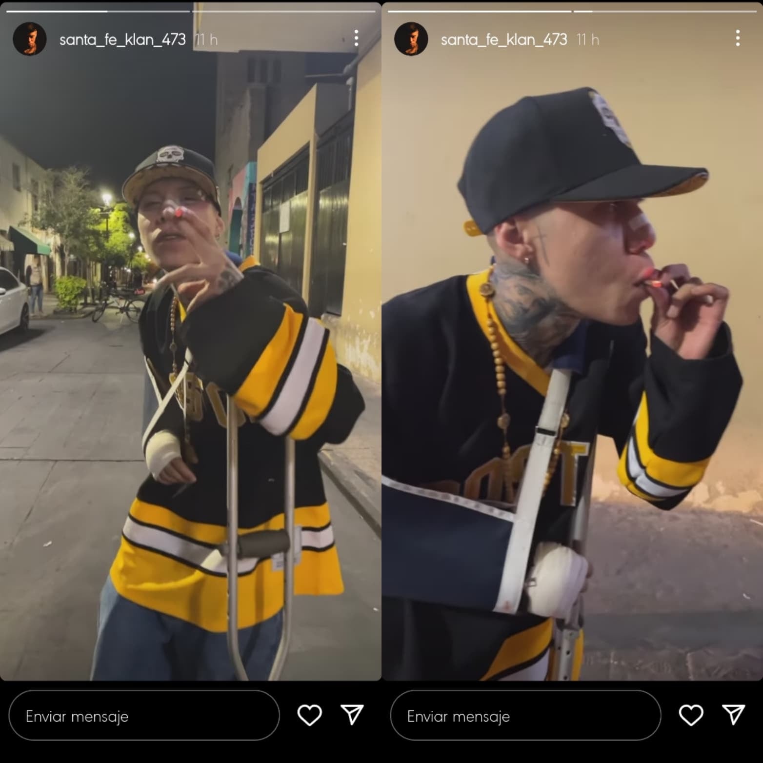 Santa Fe Klan aparece con lesiones físicas.