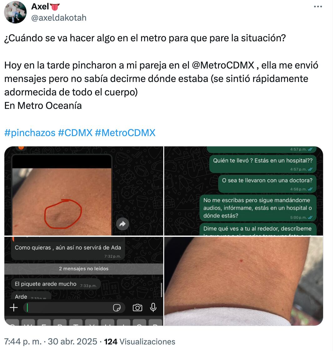 Pinchazos en el Metro CDMX: ¿cuántos casos van hasta el 30 de abril?