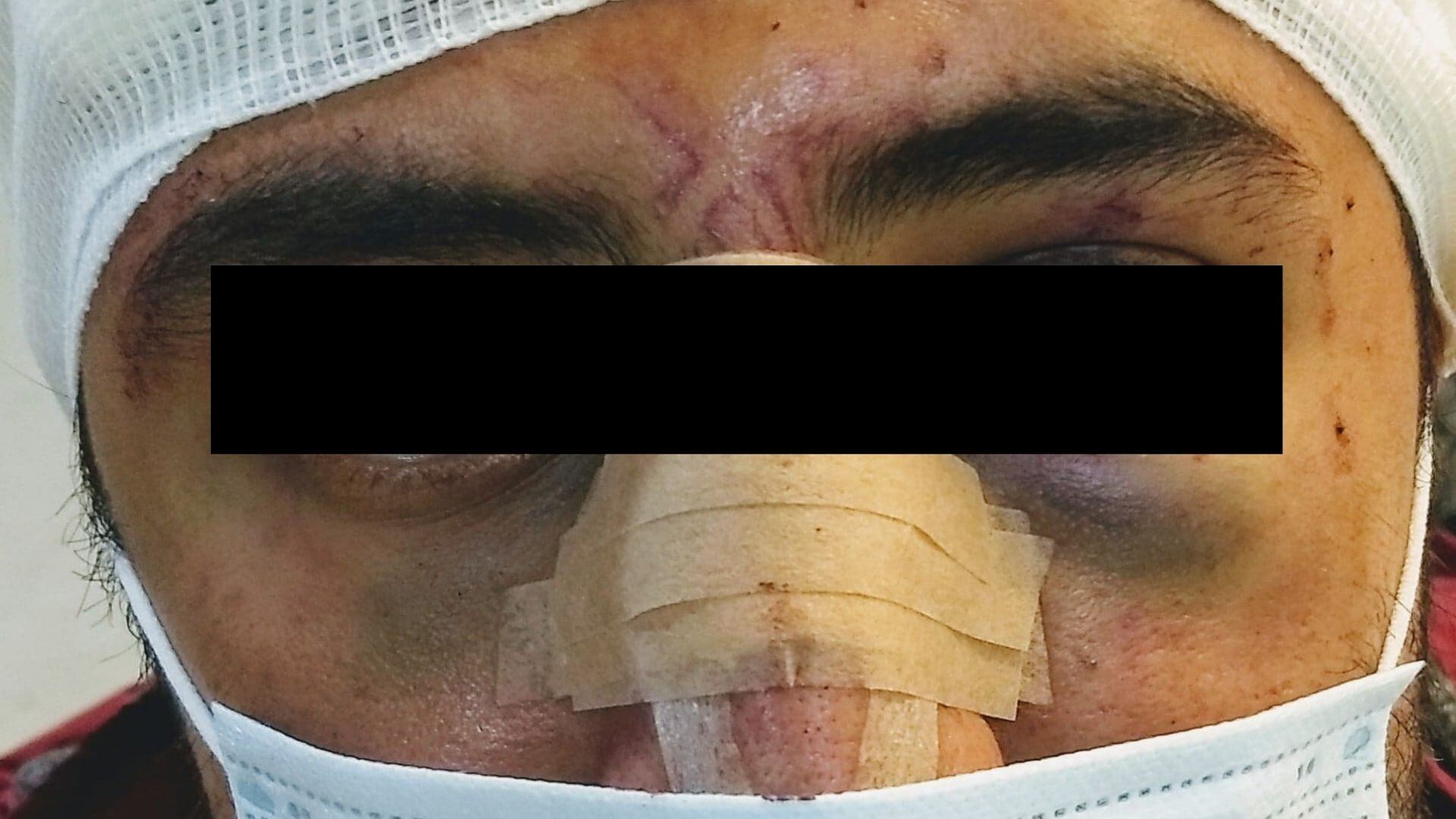 Golpes en rostro de Víctor