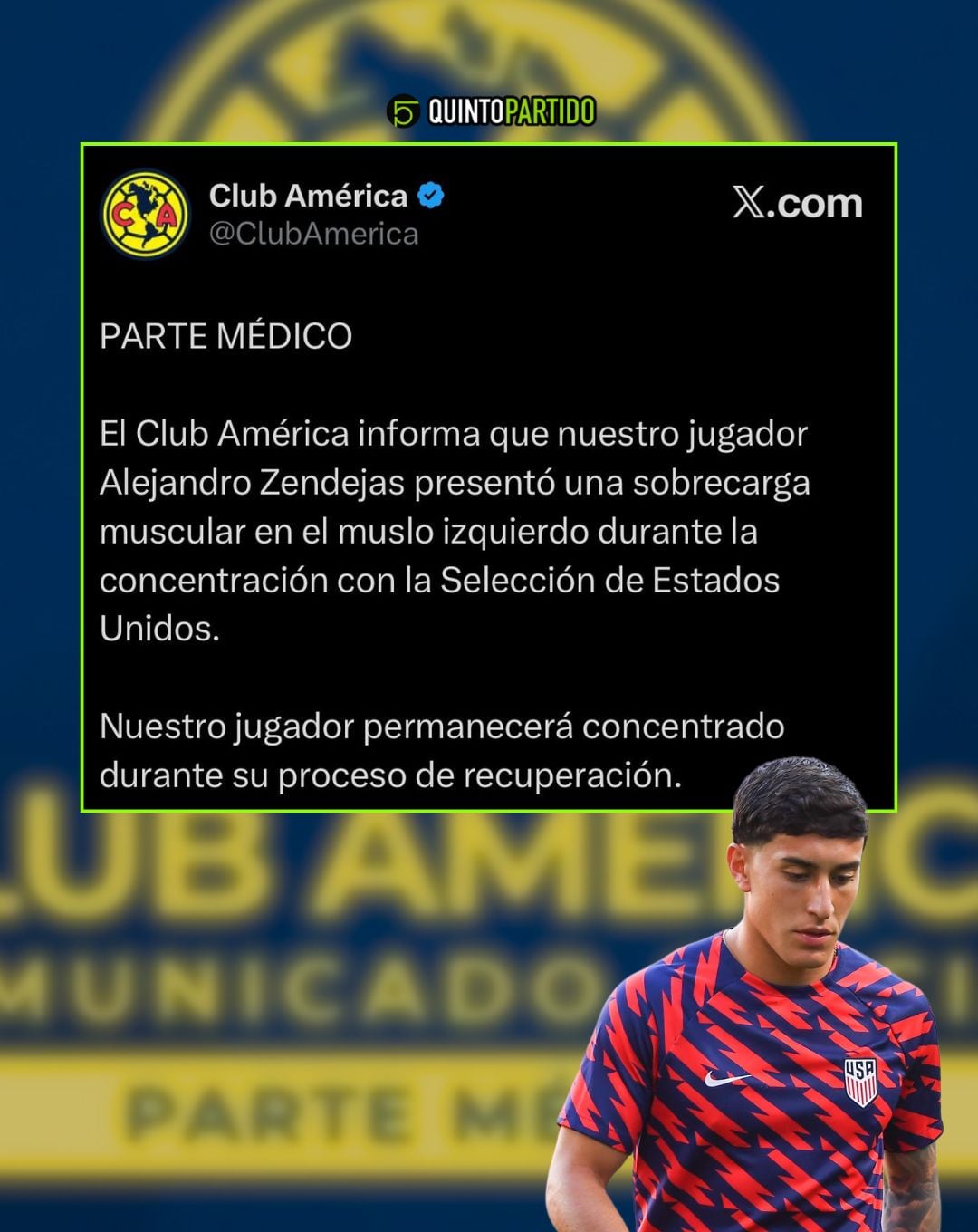 América habla sobre Alejandro Zendejas