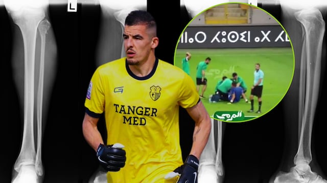 La peor lesión en la historia del futbol