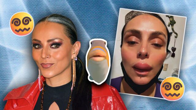 Ivonne Montero aparece con el labio hinchado y cuenta qué le pasó