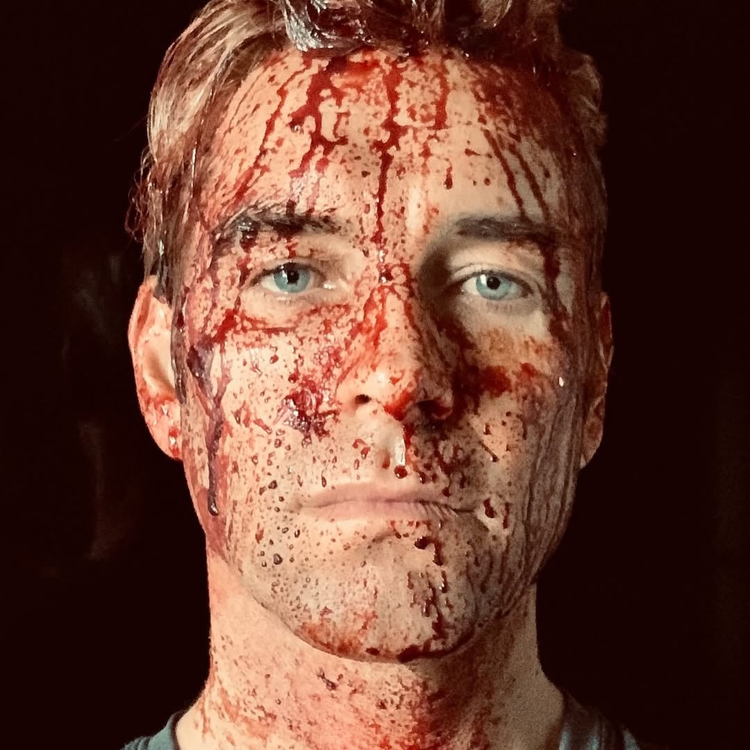 Antony Starr