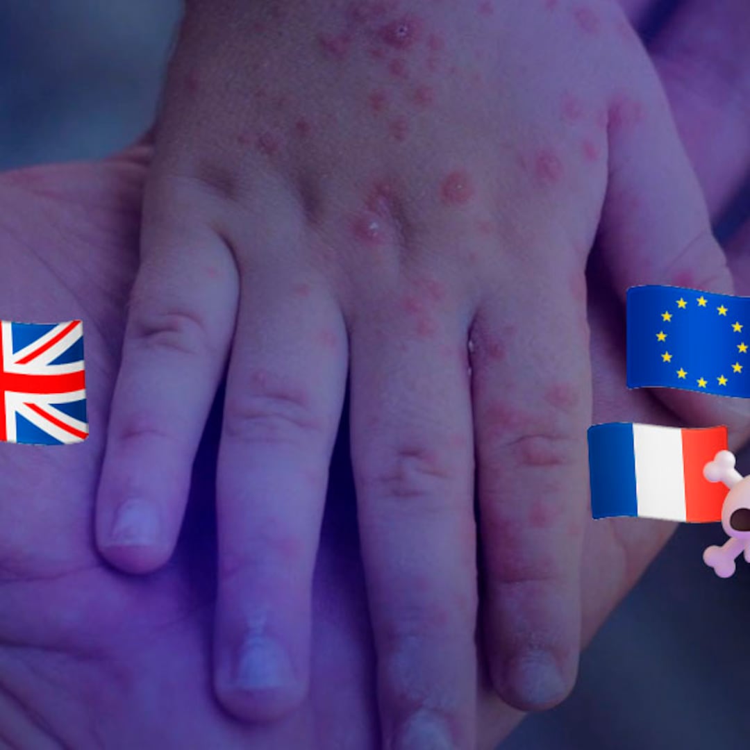Brote de meningitis avanza en Europa: primera muerte en Francia y casos en Reino Unido