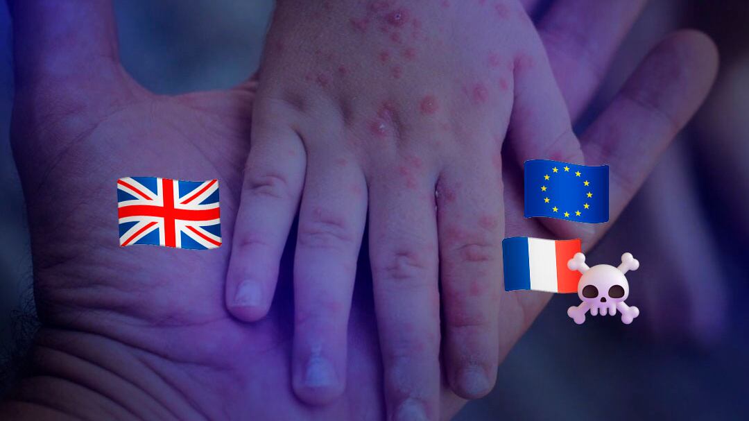 Brote de meningitis avanza en Europa: primera muerte en Francia y casos en Reino Unido