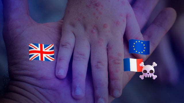 Brote de meningitis avanza en Europa: primera muerte en Francia y casos en Reino Unido