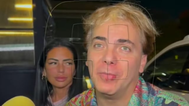 Cristian Castro preocupa por el aspecto de sus labios