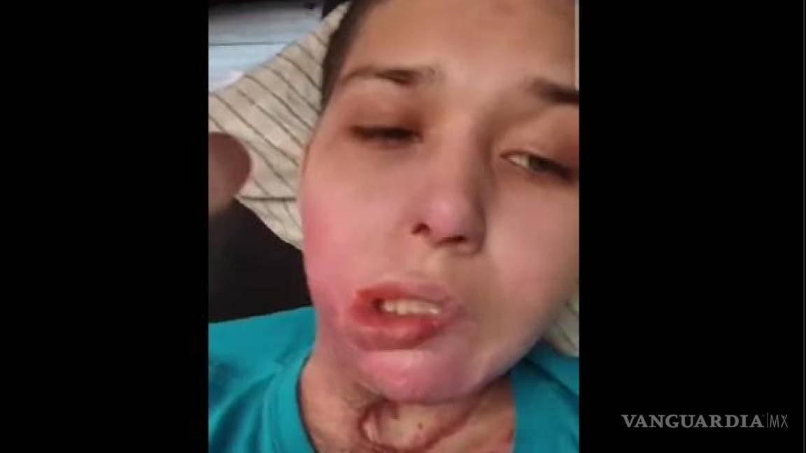 Liliana Fernández luego del ataque