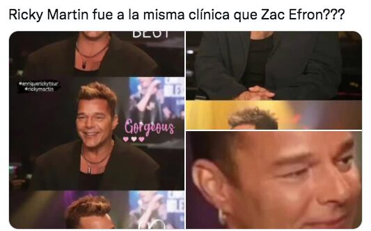Se burlan del rostro de Ricky Martin