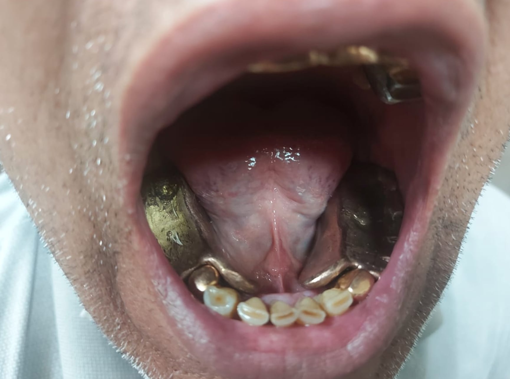 Contrabando de oro en India